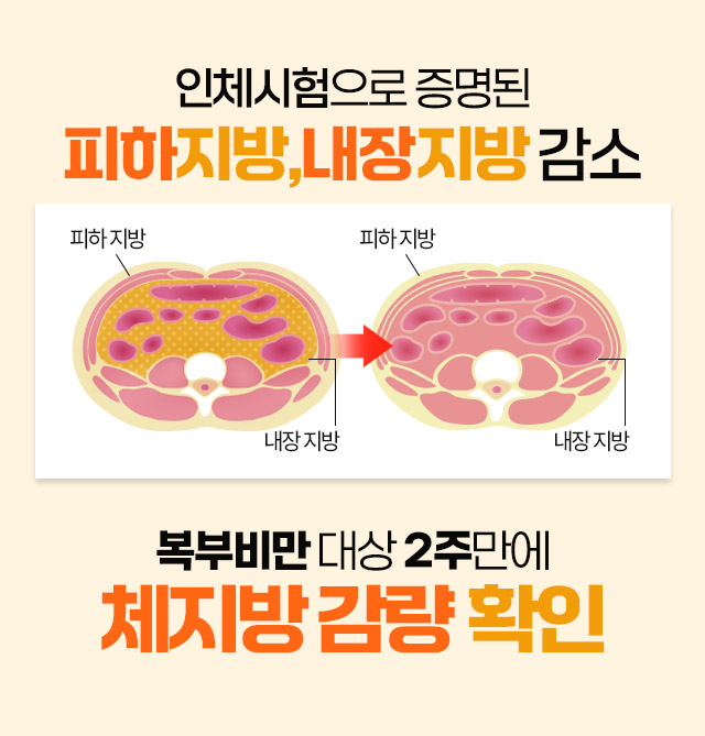 에어로빅